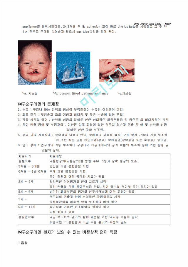 Cleft lip & palate   (6 )